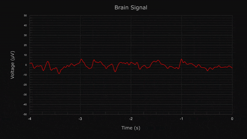 Grafische Visualisierung der EEG-Daten